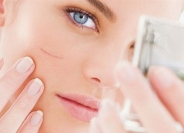 NHỮNG CÁCH LÀM MỜ SẸO THÂM HIỆU QUẢ ÍT AI BIẾT