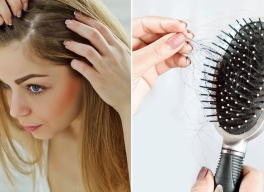 NGUYÊN NHÂN VÀ CÁCH KHÁC PHỤC RỤNG TÓC