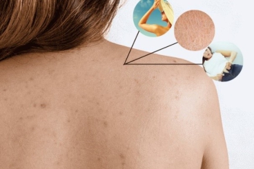 5 CÔNG THỨC TẮM TRẮNG TẠI NHÀ HIỆU QUẢ KHIẾN BẬT TÔNG DA TOÀN THÂN