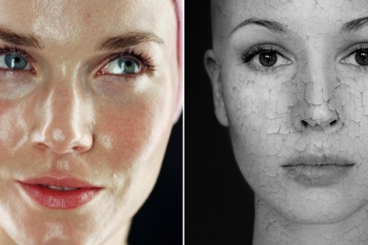 BẠN CÓ THỂ CÓ CẢ DA KHÔ VÀ DA NHỜN CÙNG MỘT LÚC KHÔNG?