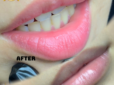 HỌC VIÊN LÊN MẪU MÔI TRƯỚC VÀ SAU KHI BONG