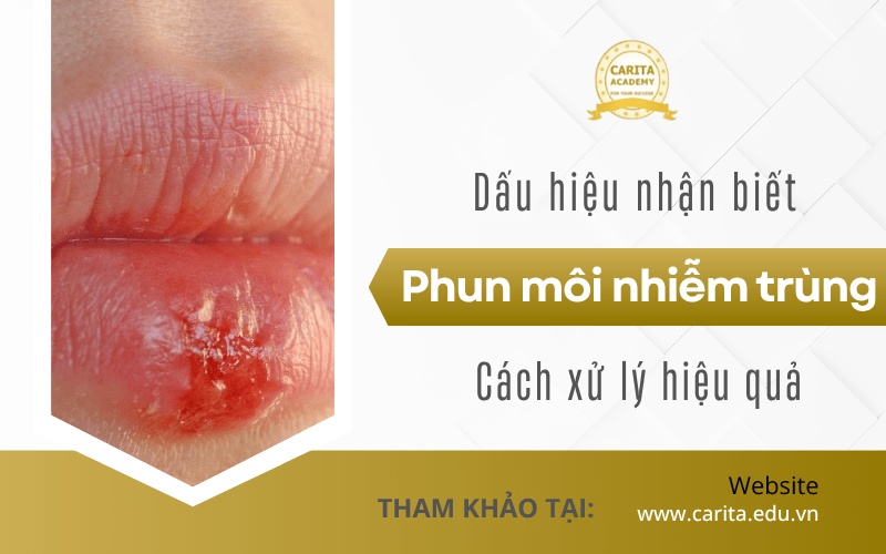 phun môi nhiễm trùng