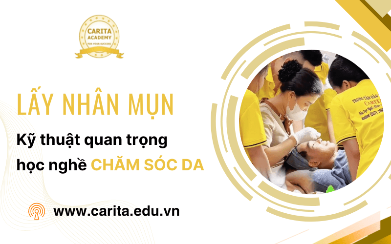 lấy nhân mụn