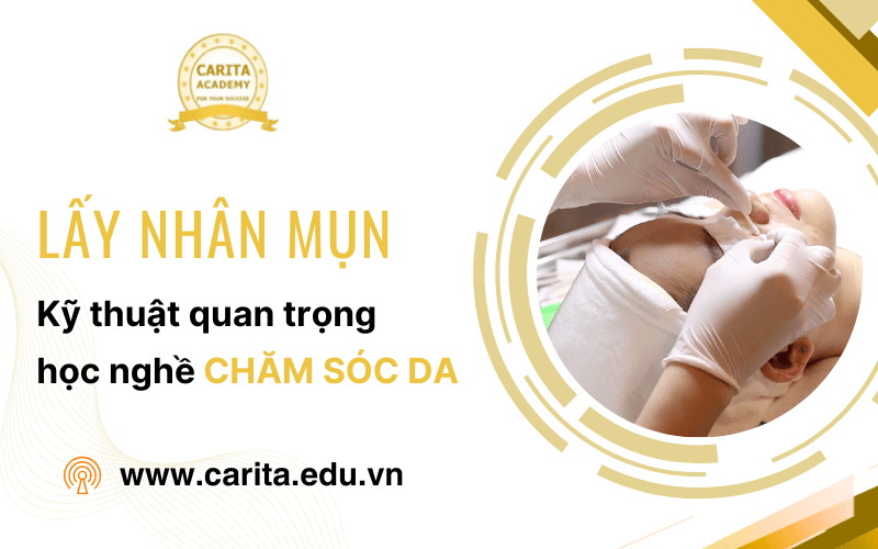 lấy nhân mụn