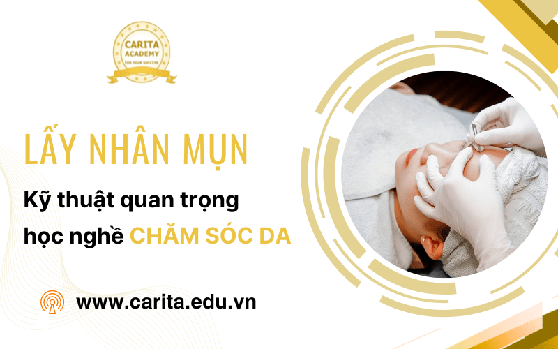lấy nhân mụn