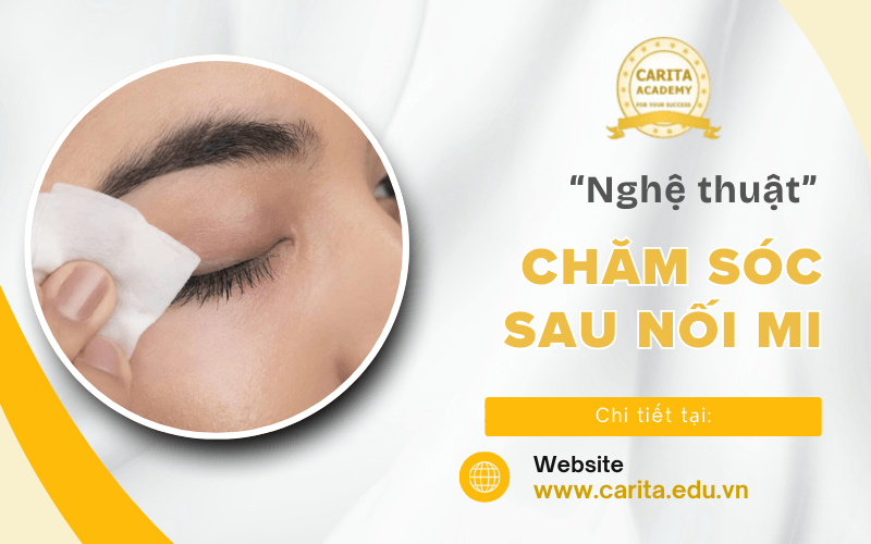 nối mi