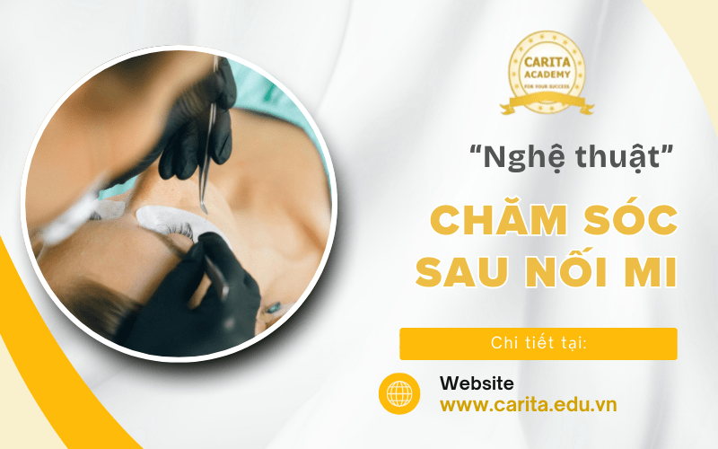 nối mi