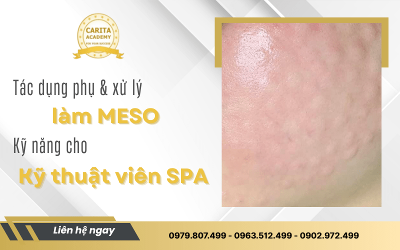 kỹ thuật viên spa